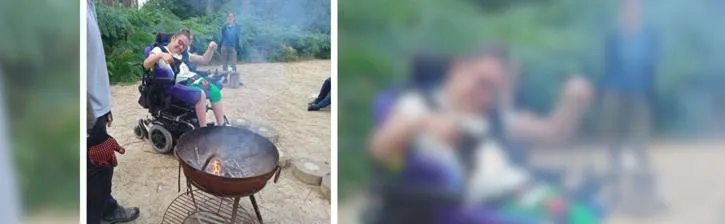 Young disabled person with friends around a fire pit.